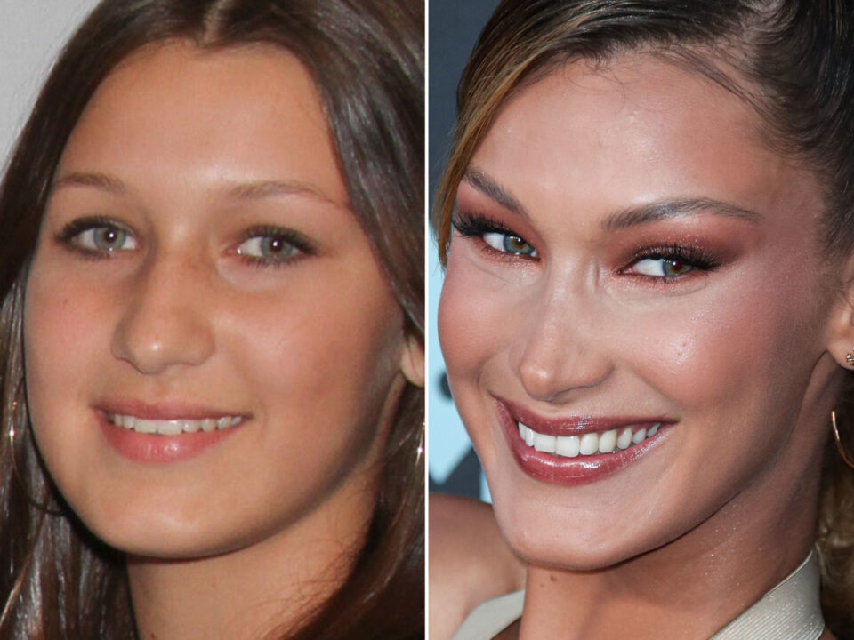 Bella Hadid avant et après De 2010 à 2024