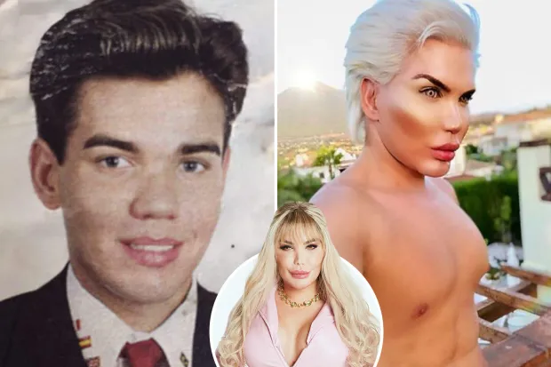 The Human Ken Doll chirurgie esthétique